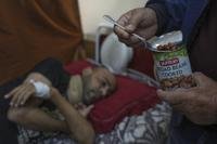 A man who was injured in a bombing and lost his foot, is fed beans by his father.